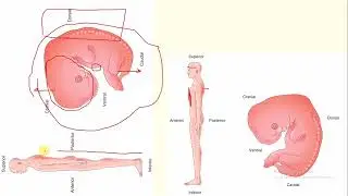 مقدمة الاسبوع 3 + الثلم الابتدائي