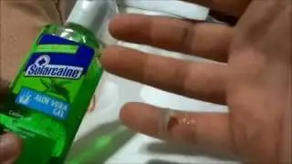 How To Treat A Burn On A Finger