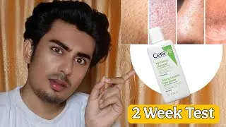 👉 CeraVe Hydrating Cleanser Review | Best Face Wash for Dry & Sensitive Skin | Skincare Routine