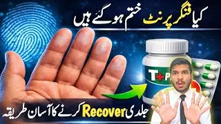  fingerprint ko jaldi recover kaise karen ✅️ fingerprint problem solutior