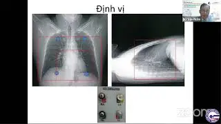 #2.2 Triple Rule Out CT Scan Technique at Cho Ray Hospital &ndash; Bui Van Pham