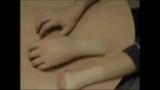 RTM Ortopedia:  partial amputation of the hand   cosmetic silicon