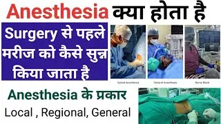 Anesthesia क्या होता है - कितने प्रकार का होता है || Local , Regional & General Anesthesia(in hindi)