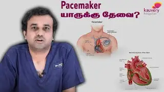 Who needs a Pacemaker | யாருக்கு இதயமுடுக்கி (பேஸ்மேக்கர்) தேவை?