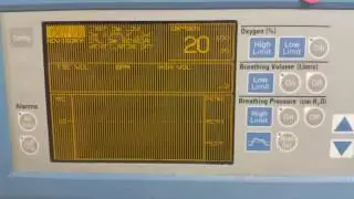 Narkomed GS Display Flicker