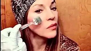 Micro-Needling with Dr. Dot