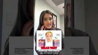 Masseter Botox in Chicago | Slim Jawline & TMJ Relief at New Image Works