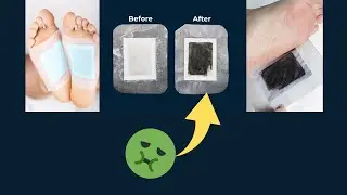 Does Xitox&trade; Foot Pads Works?  SIMPLE PROMISE