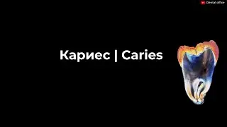 Кариес | Современные представления о кариесе | Откуда берется кариес ? Dental caries