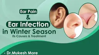 Ear Pain & Ear Infection in Winter Season | Its Causes & Treatment - Dr. Mukesh More