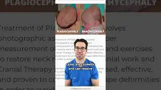 What Is Flat Head Syndrome in Babies? 👶 | Dr. Yoshi on Causes, Treatment & Prevention