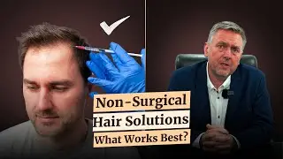 Non-Surgical Hair Treatments: What Works Best?