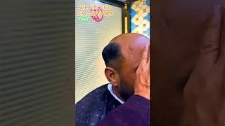 Natural Hair patch system #Multan #Bahawalpur #D.G.Khan #Raheem Yar Khan #Khanewal #MuzafarGhar
