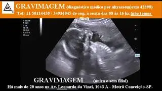 GRAVIMAGEM 24815 ULTRASSOM DE GRAVIDEZ com 22 SEMANAS
