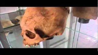 Paracas Museum Peru: Elongated Skull Collection