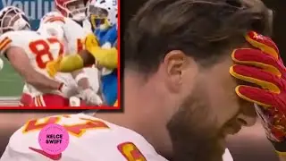 Travis Kelce DID THIS after he got SLAPPED in the face by Chargers Teair Tart in Brasil
