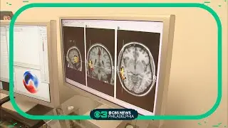 What doctors are seeing as the number of young people with Parkinson's disease grows