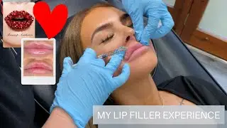 Я СДЕЛАЛА ГУБЫ!!!! | МОЙ ОПЫТ С ФИЛЛЕРОМ ГУБ | МОЙ РОЖДЕСТВЕНСКИЙ ПОДАРОК ​​ДЛЯ СЕБЯ | ВИДЕОБЛОГ 2019