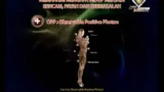 Penyelesaian Melalui AFTL Virtual Negative Photon (VNP)