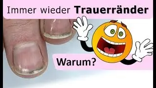 Endlich kein Dreck mehr unter den N&auml;geln!