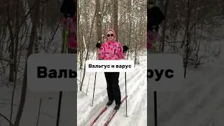 Причины деформации ног #медицина #доктор #зож #терапевт #дети #семья #новыйгод