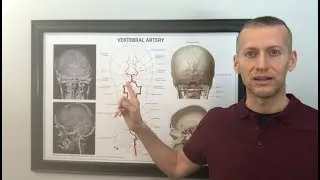 Is your brain stem getting the blood flow it needs? What are the effects of a kinked upper neck?￼