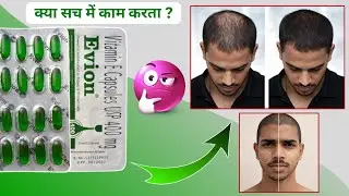 Evion 400 Uses in Hindi | Evion 400 Capsule खाने के फायदे | Evion 400 for skin | Evion 400 for hair 