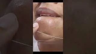 #threading #skincare #threadingathome #hairremovalmethods #satisfying #hairremoval