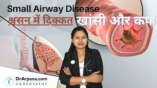 श्वसन में कमी, खांसी और कफ SMALL AIRWAY DISEASE
