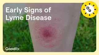 Early Signs of Lyme Disease: Key Symptoms to Spot | GoodRx