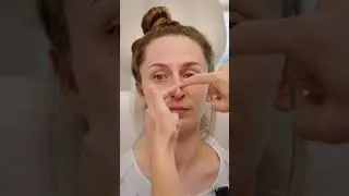Fixing Her Crooked Nose👃🏼 📐✨