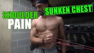Shoulder Pain & Pectus Excavatum (HERES WHY & HOW TO FIX!)
