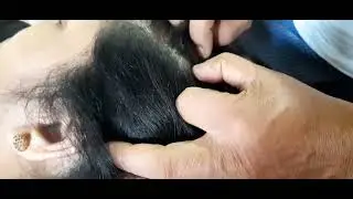 😴🌜Scalp checking video to sleep
