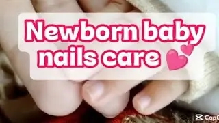 Newborn Baby Nails Care | Baby Nails Kaise Cut Karein Safely