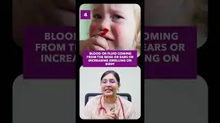 Head injury in baby when to worry? | Dr Anusha Rao #headinjury #babyhealth