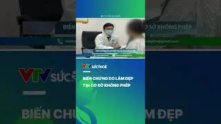 Sẹo lồi khắp mặt v&igrave; l&agrave;m đẹp da| VTV Sức khỏe  #vtvdigital #vtvsuckhoe #news#shorts