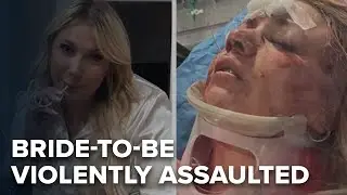 Bride to be violently attacked during bachelorette trip