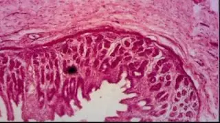 Stomach wall lining sction