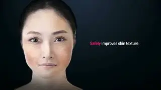 PicoLO&trade; | The Next Generationof Picosecond Laser