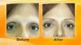 Permanent Makeup, FeatherStroke Eyebrows