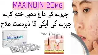 Maxinoin Capsule | Isotretinoin capsule uses in Urdu | Maxinoin capsule benegfits and how to use