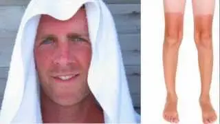 Sun Damage - What is it?