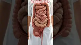 Realistic Human Anatomy Visualization Severe constipation
