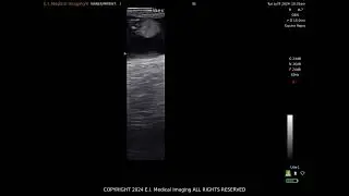 Equine Fetal Sexing - SA2 Ultrasound and eL7 Transducer #6