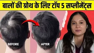 5 Supplements for hair growth | Video by Dr. Smita Bhoir Patil