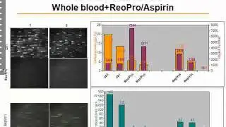 Cellix Webinar:  Thrombosis