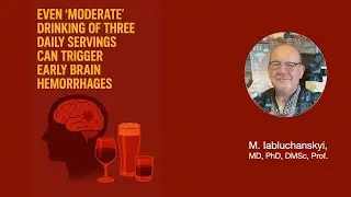 Even &ldquo;Moderate&rdquo; Drinking of Three Daily Servings Can Trigger Early Brain Hemorrhages