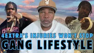 No Jumper Host 4Xtra Must Learn The Hard Way After Burning His Face & Losing Fingers