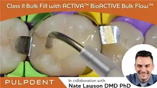 Class II Restoration with ACTIVA&trade; BioACTIVE Bulk Flow&trade; presented by Dr. Nate Lawson
