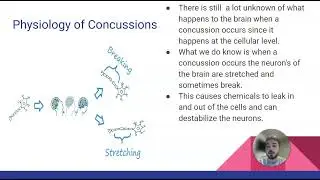 Concussion Presentation